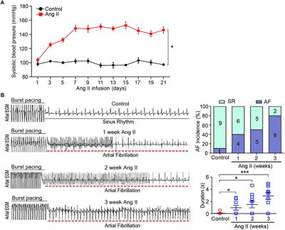 Time Series Gene Expression Profiling and Temporal Regulatory Pathway Analysis of Angiotensin II Induced Atrial Fibrillation in Mice